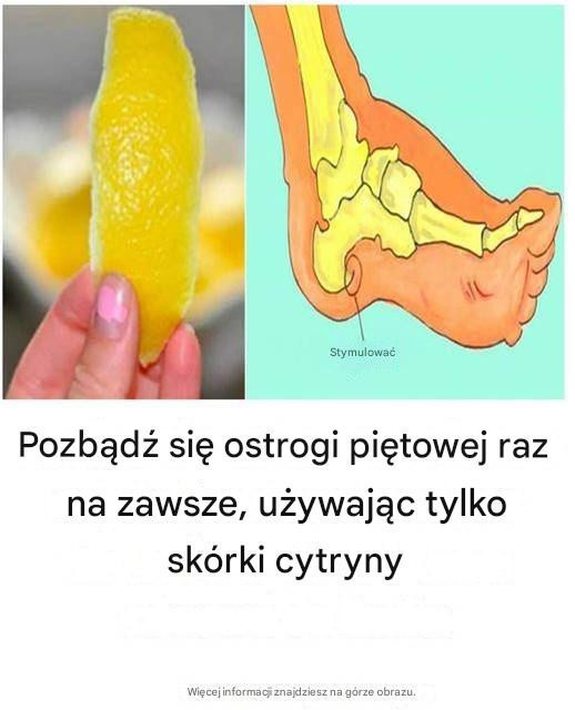 Naturalny sposób na ostrogę piętową: Terapia z użyciem skórki cytrynowej