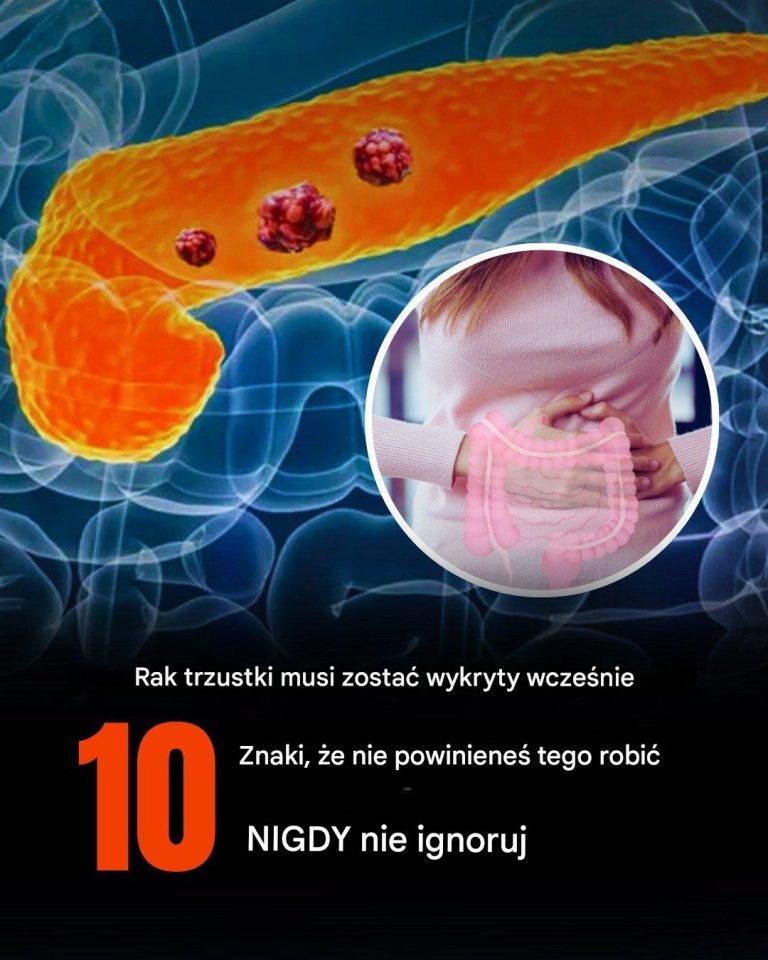 Rak trzustki wymaga wczesnego leczenia. Objawy, na które należy zwrócić uwagę