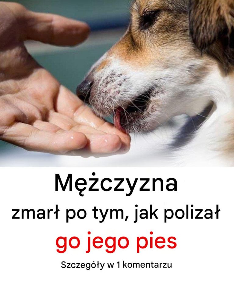 Mężczyzna zmarł po tym, jak polizał go jego pies