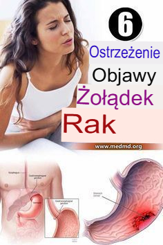 6 ostrzegawczych znaków raka żołądka