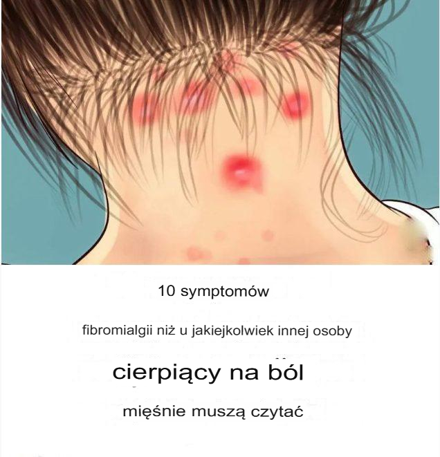 10 objawów fibromialgii, które powinien przeczytać każdy, kto cierpi na bóle mięśni