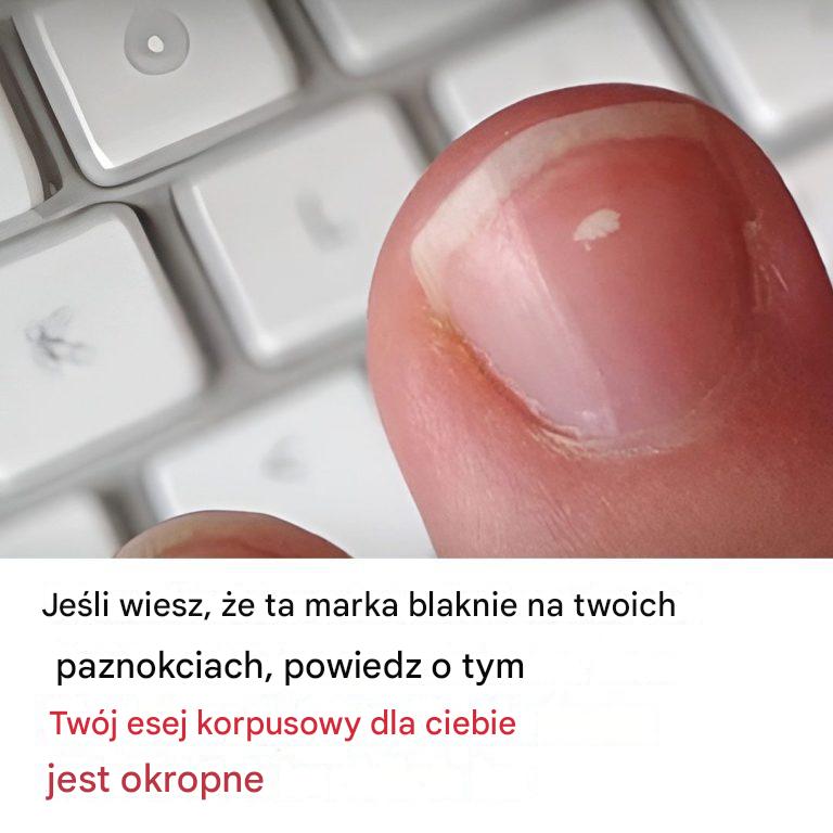 Dlaczego na paznokciach pojawiają się białe plamki?