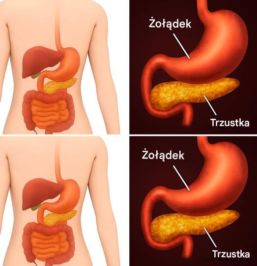 Jak detoksykację i przyspieszyć trzustki, aby schudnąć