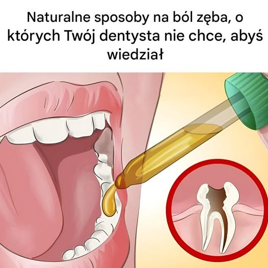 Naturalne sposoby na ból zęba