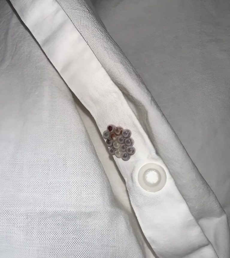 Znalazłem te małe kulki w moim łóżku i prawie dostałem zawału serca. Powiem ci, co to było.