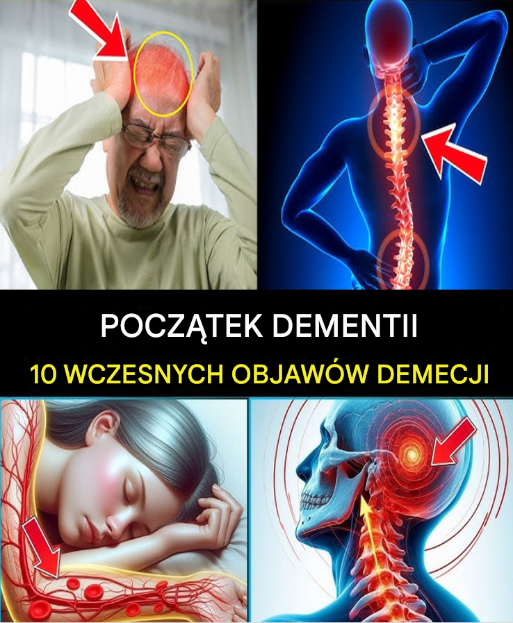 7 Wczesnych Objawów Alzheimera – Jak Rozpoznać Wczesne Wyzwania z Pamięcią