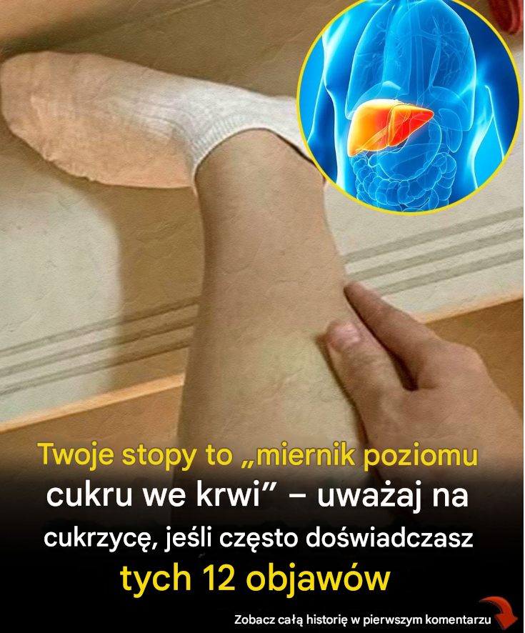 12 objawów cukrzycy związanych ze stopami, które mogą wskazywać na wysoki poziom cukru we krwi