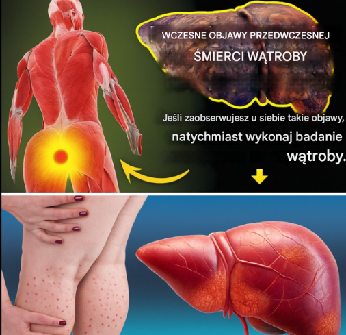Myślisz, że jesteś zdrowy? Ale Twoja wątroba może się z tym nie zgadzać… Nie ignoruj ​​tych 12 ukrytych sygnałów ostrzegawczych!